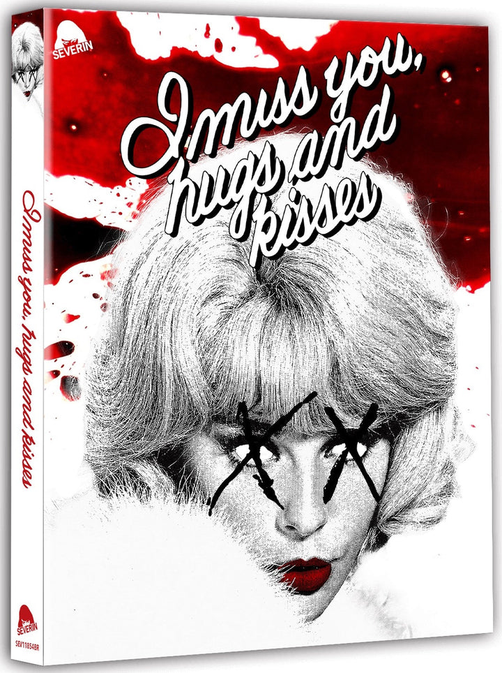 I Miss You Hugs & Kisses [2-Disc Blu-ray w/Slipcover]