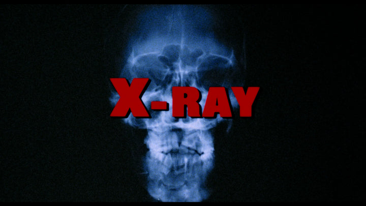 SCHIZOID / X-RAY